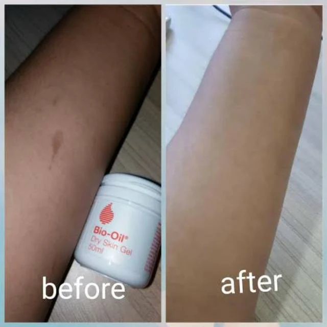 Bio-Oil Hydrating Dry skin Gel - Image 7